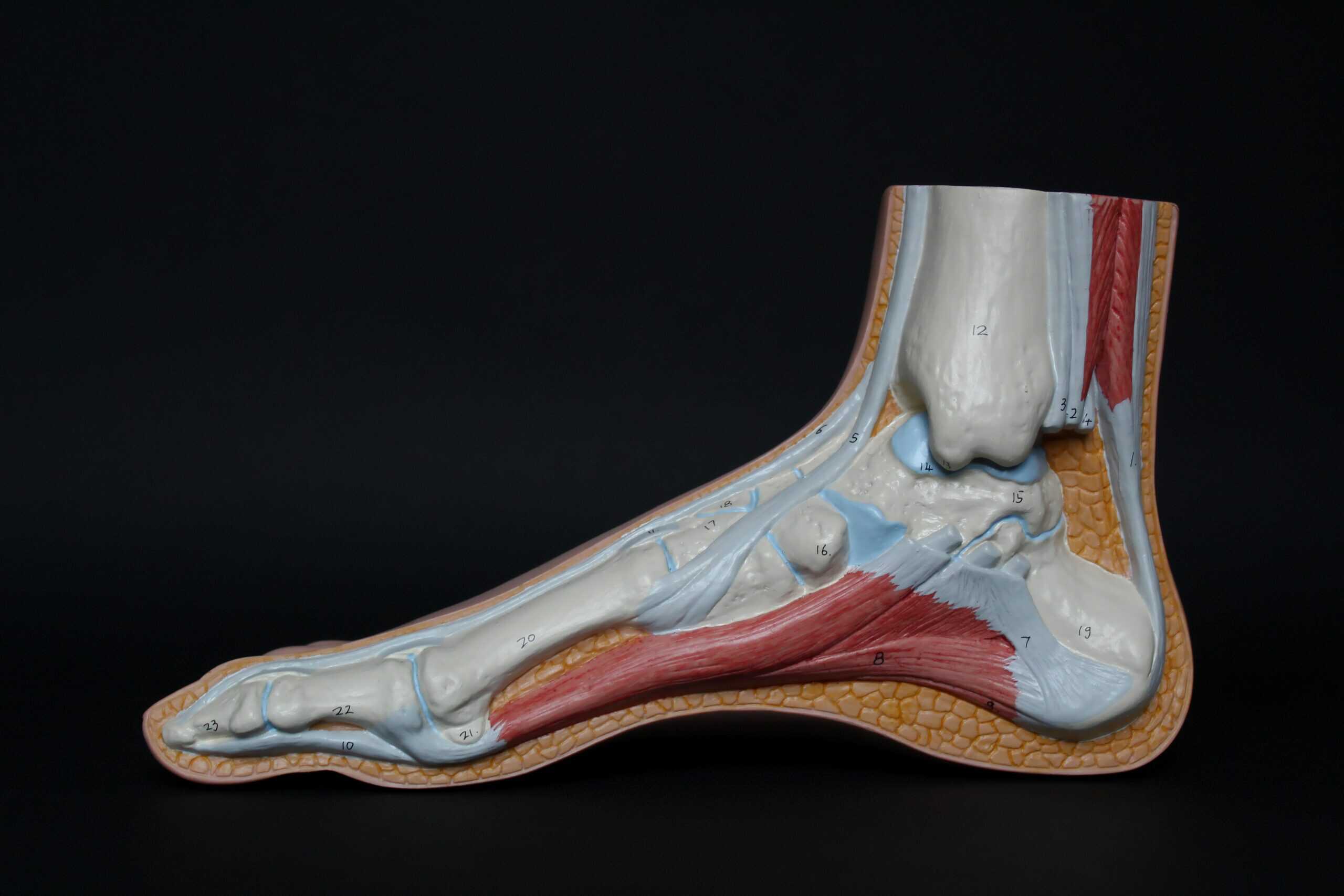 foot pain - plantar fasciitis